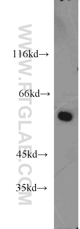 Western Blot (WB) analysis of mouse kidney tissue using UNC5D-Specific Polyclonal antibody (20241-1-AP)