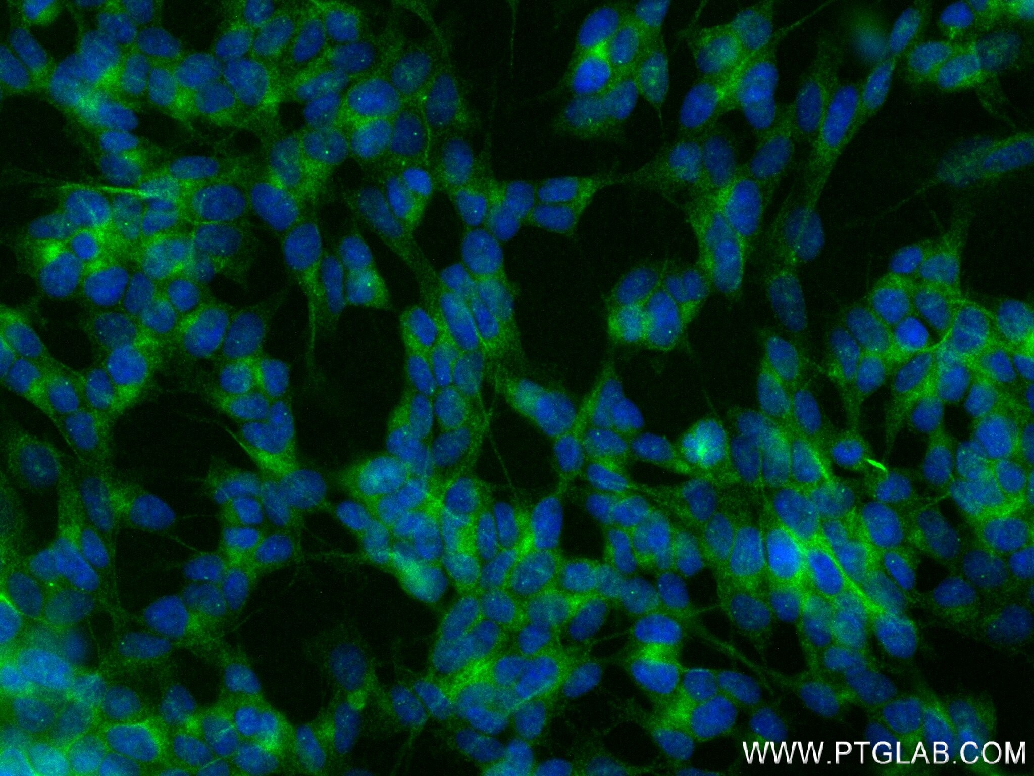 Immunofluorescence (IF) / fluorescent staining of SH-SY5Y cells using UNC79 Recombinant antibody (84642-1-RR)