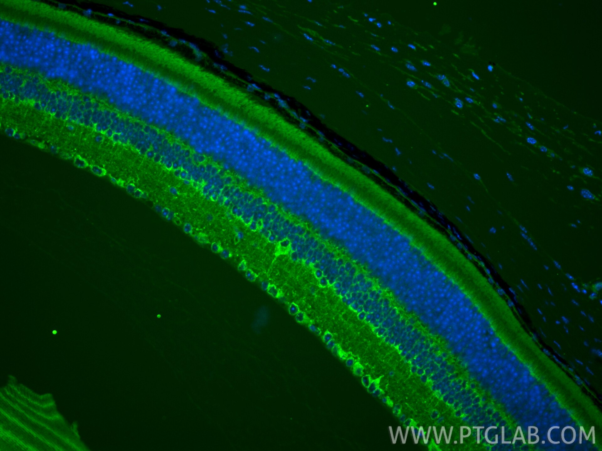 IF Staining of mouse eye using 84642-1-RR (same clone as 84642-1-PBS) Immunofluorescence (IF) / fluorescent staining of mouse eye tissue using UNC79 Recombinant monoclonal antibody (84642-1-RR)