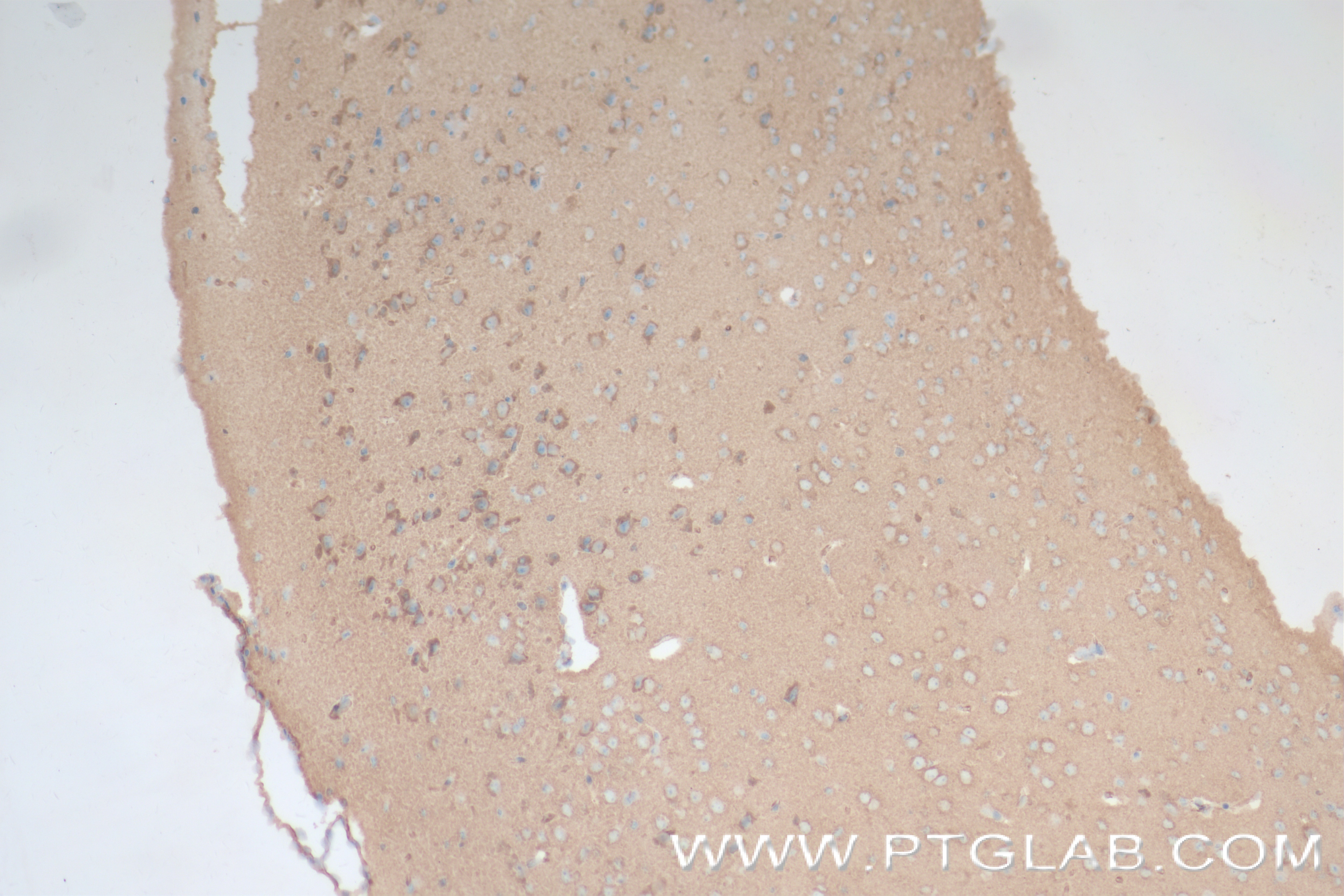 Immunohistochemistry (IHC) staining of mouse brain tissue using UNC79 Recombinant antibody (84642-1-RR)