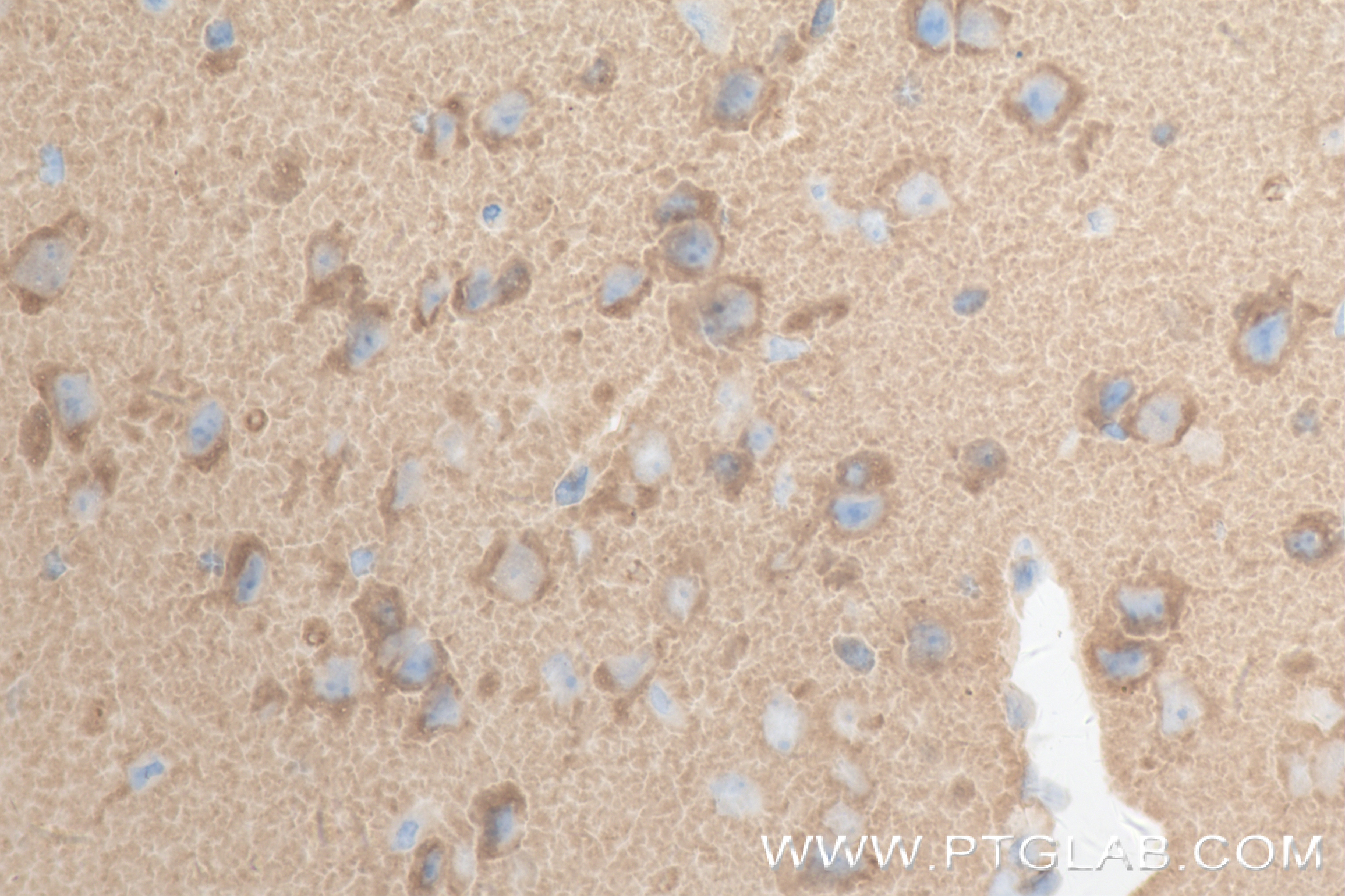 Immunohistochemistry (IHC) staining of mouse brain tissue using UNC79 Recombinant antibody (84642-1-RR)