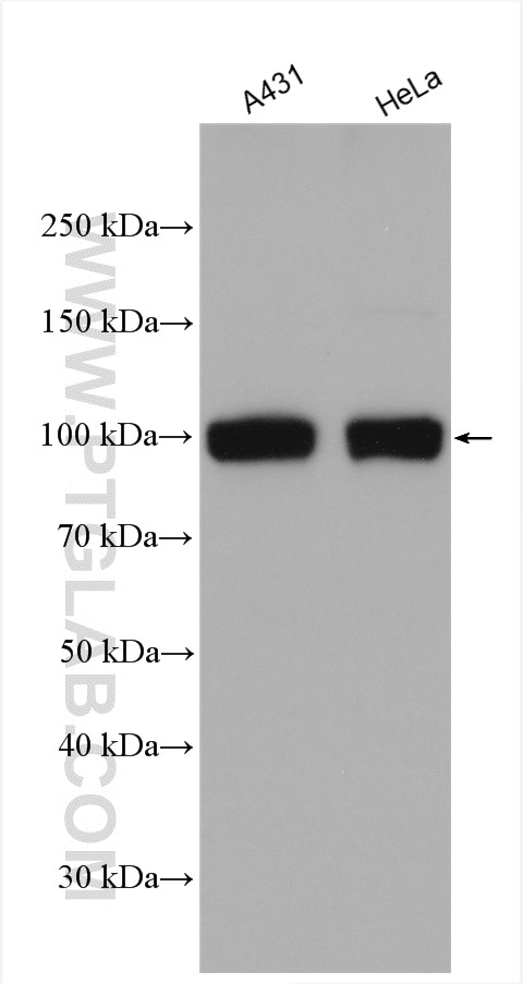 Western Blot (WB) analysis of various lysates using SUN1 Polyclonal antibody (24568-1-AP)