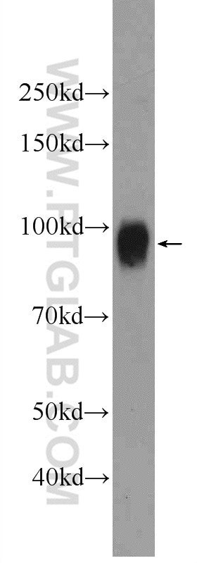 Western Blot (WB) analysis of Jurkat cells using SUN1 Polyclonal antibody (24568-1-AP)