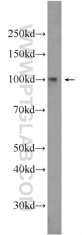 Western Blot (WB) analysis of K-562 cells using SUN1 Polyclonal antibody (24568-1-AP)