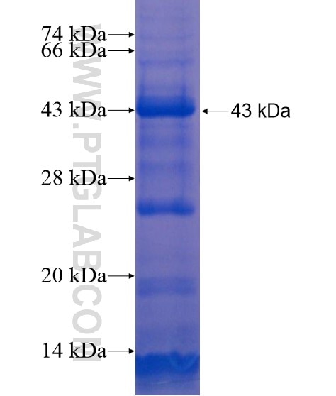 UNC84A fusion protein Ag21117 SDS-PAGE