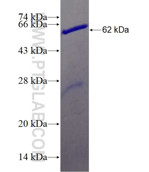 UNC84B fusion protein Ag16077 SDS-PAGE