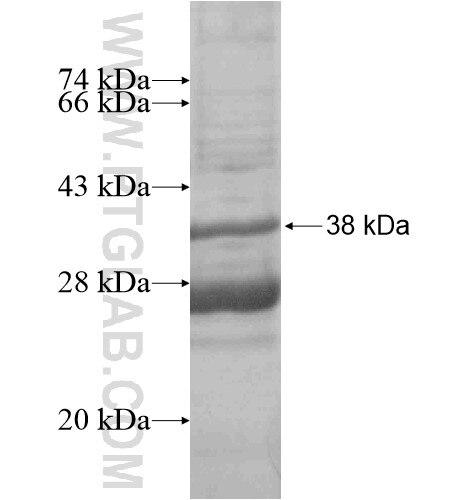 UNC93A fusion protein Ag15831 SDS-PAGE