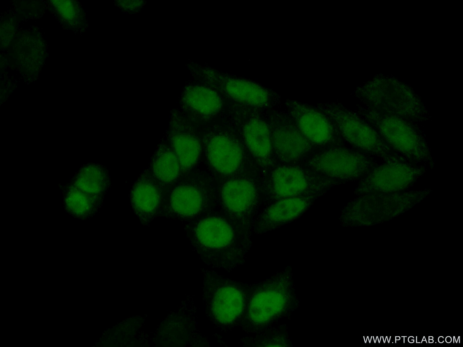 Immunofluorescence (IF) / fluorescent staining of HeLa cells using UNG Polyclonal antibody (12394-1-AP)