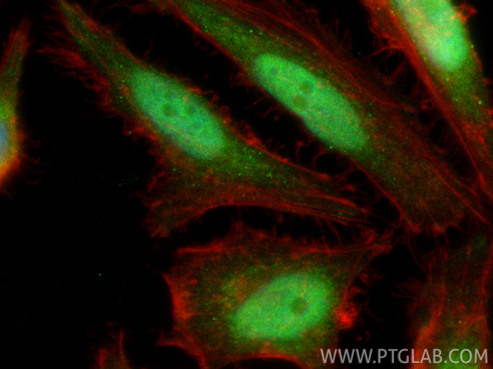 Immunofluorescence (IF) / fluorescent staining of HeLa cells using UNG Polyclonal antibody (12394-1-AP)