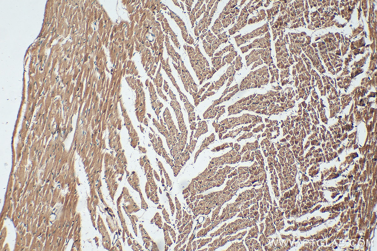 Immunohistochemistry (IHC) staining of mouse heart tissue using UNG Polyclonal antibody (12394-1-AP)