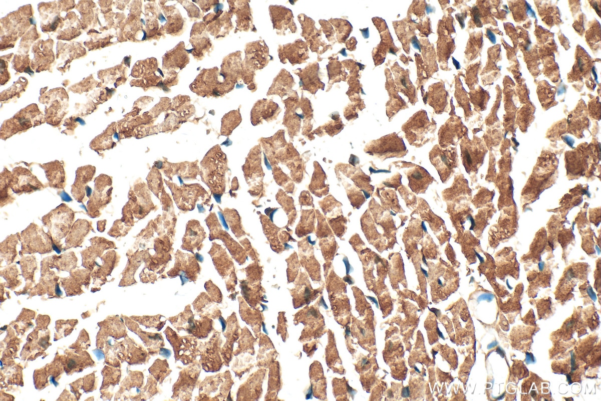 Immunohistochemistry (IHC) staining of mouse heart tissue using UNG Polyclonal antibody (12394-1-AP)