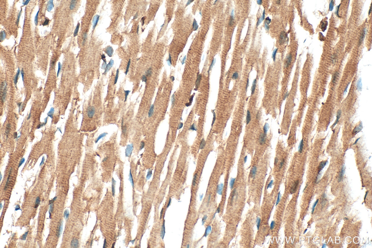 Immunohistochemistry (IHC) staining of mouse heart tissue using UNG Polyclonal antibody (12394-1-AP)