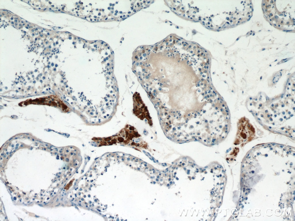 Immunohistochemistry (IHC) staining of human testis tissue using UNG Polyclonal antibody (12394-1-AP)