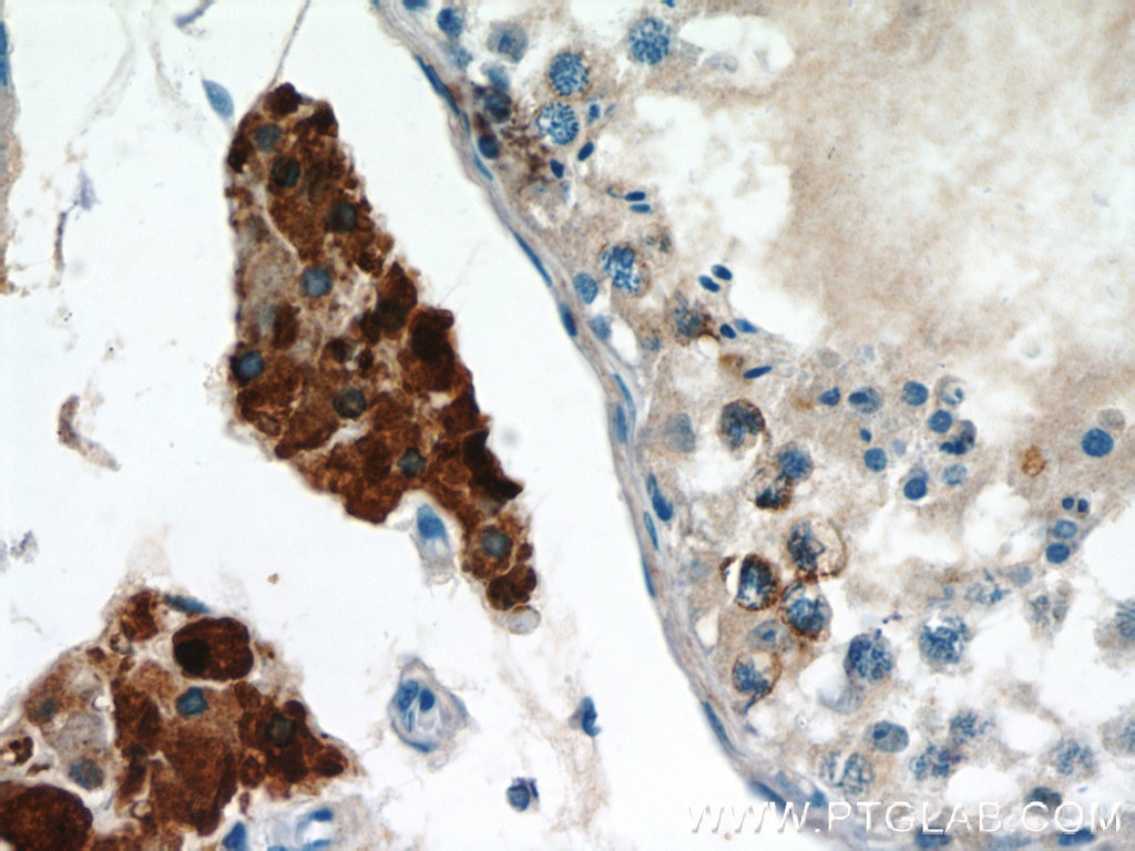 Immunohistochemistry (IHC) staining of human testis tissue using UNG Polyclonal antibody (12394-1-AP)