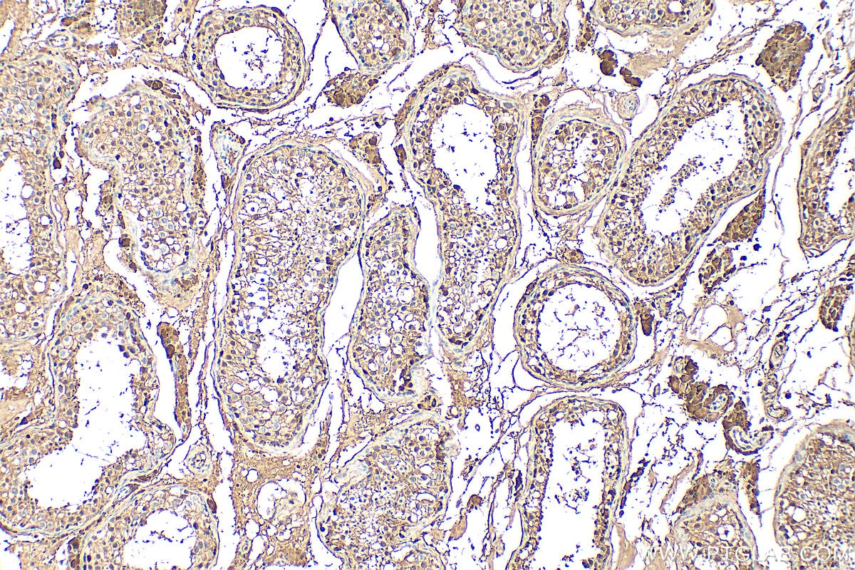 Immunohistochemistry (IHC) staining of human testis tissue using UNG Polyclonal antibody (12394-1-AP)