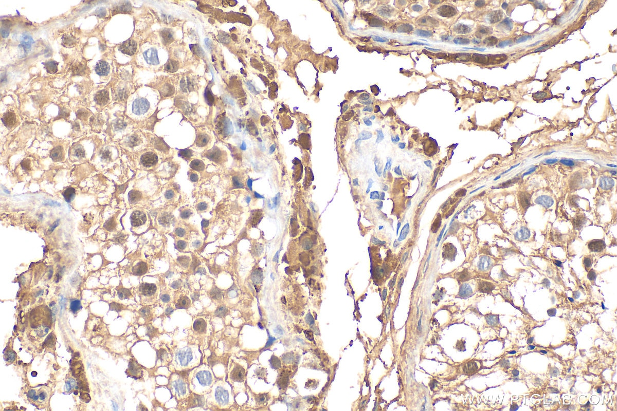Immunohistochemistry (IHC) staining of human testis tissue using UNG Polyclonal antibody (12394-1-AP)