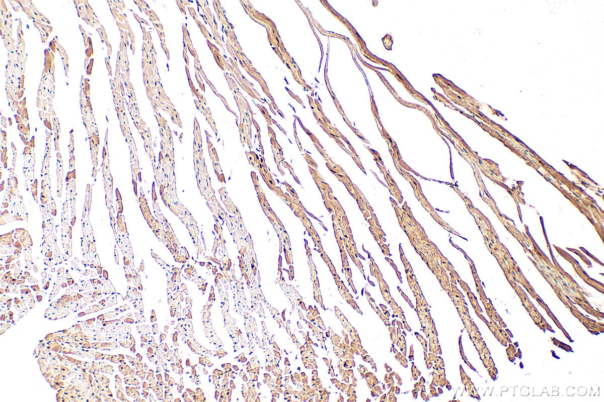 Immunohistochemistry (IHC) staining of mouse heart tissue using UNG Polyclonal antibody (12394-1-AP)