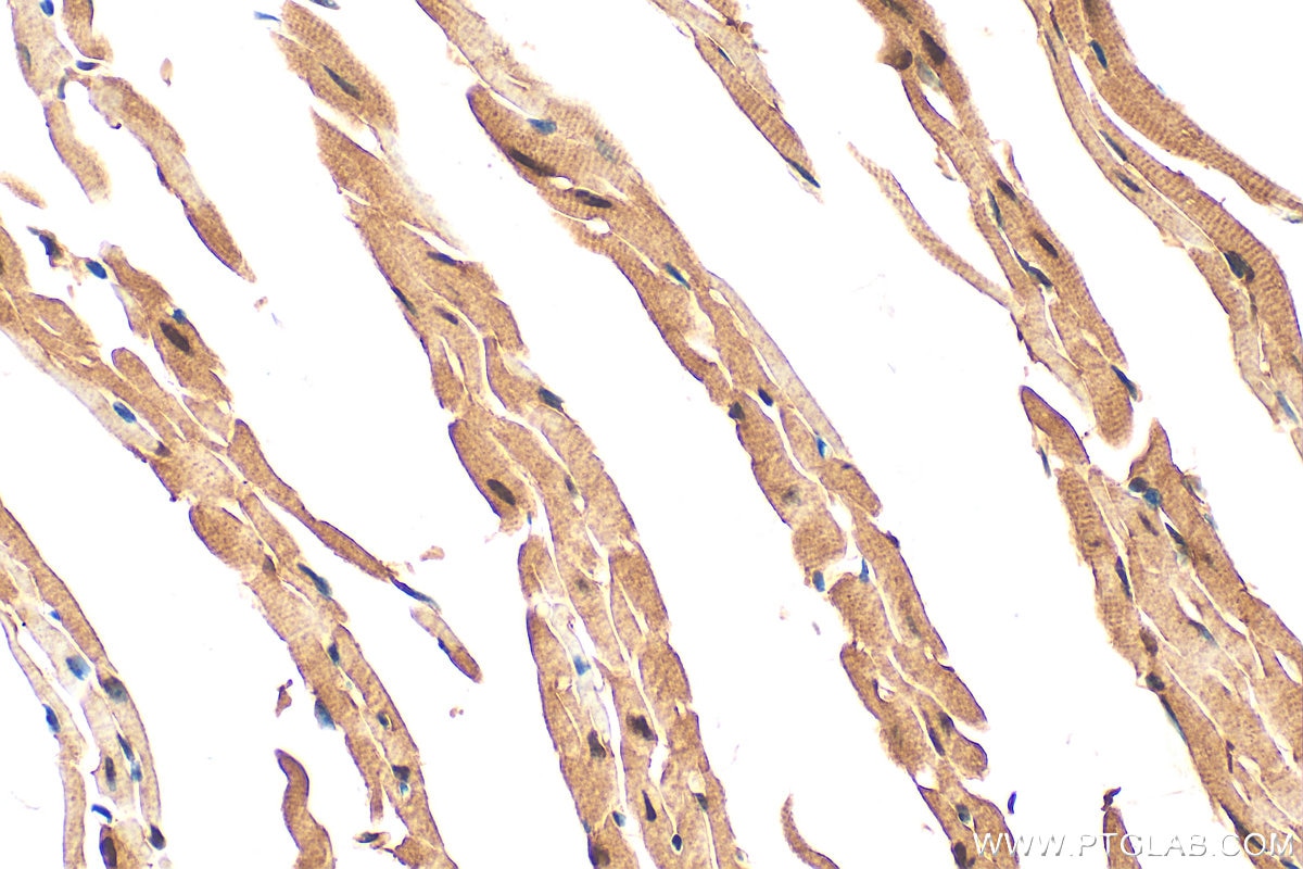 Immunohistochemistry (IHC) staining of mouse heart tissue using UNG Polyclonal antibody (12394-1-AP)