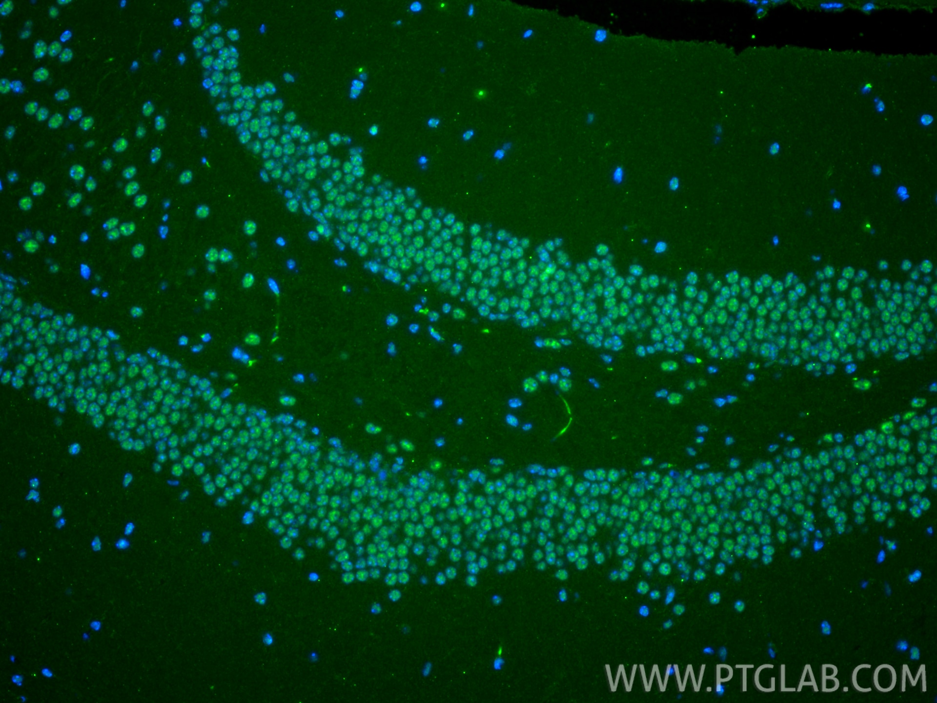 Immunofluorescence (IF) / fluorescent staining of mouse brain tissue using UNG Monoclonal antibody (67490-1-Ig)