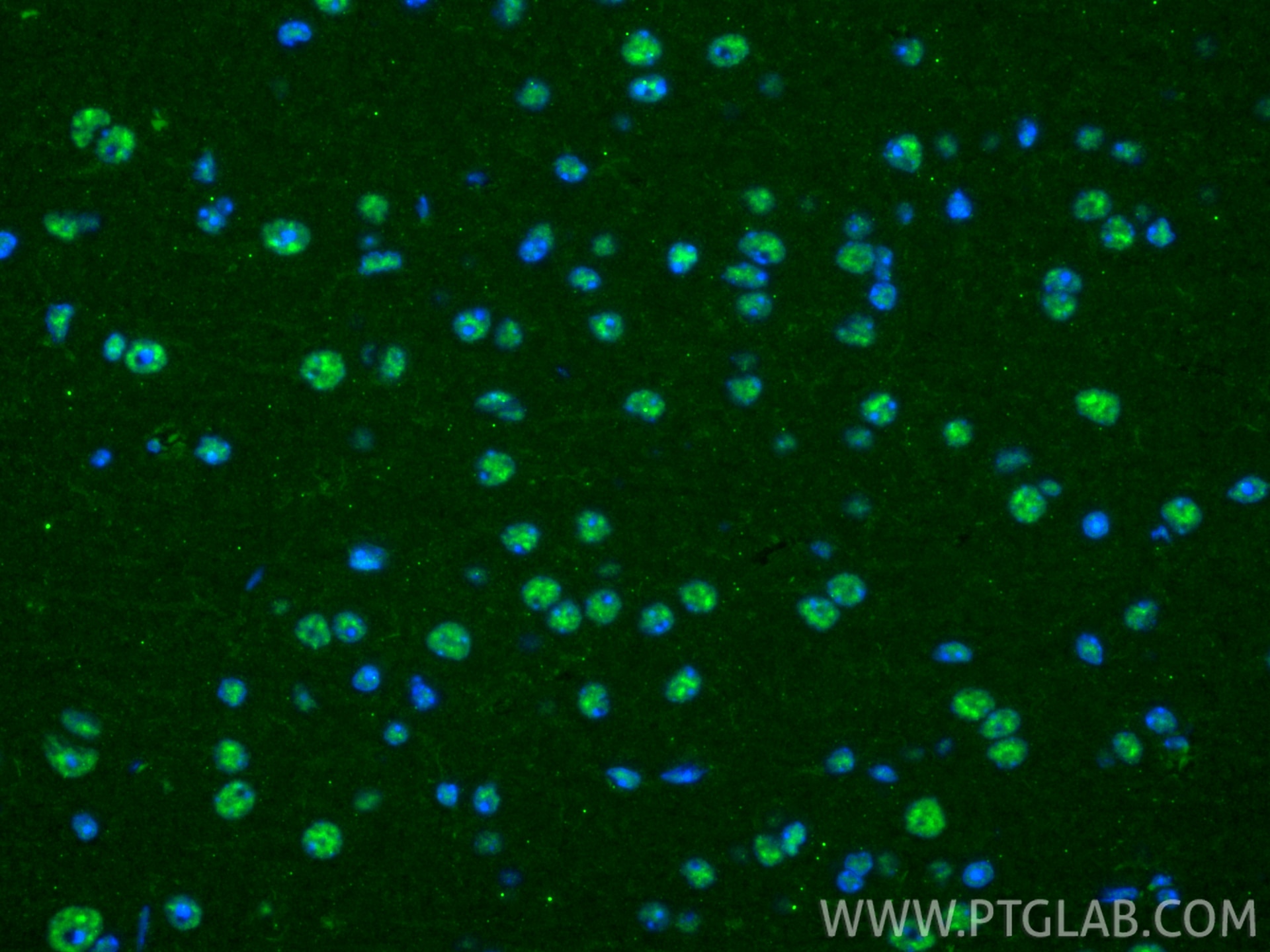 Immunofluorescence (IF) / fluorescent staining of mouse brain tissue using UNG Monoclonal antibody (67490-1-Ig)