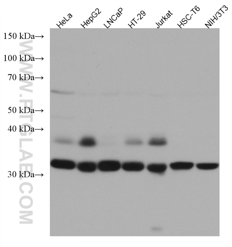 Western Blot (WB) analysis of various lysates using UNG Monoclonal antibody (67490-1-Ig)