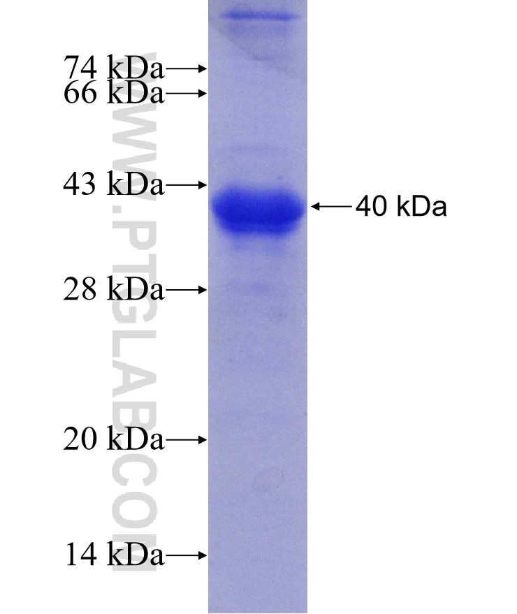UNG fusion protein Ag29979 SDS-PAGE