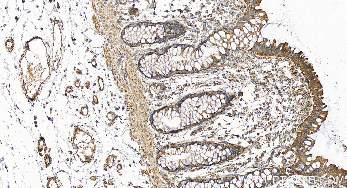 Immunohistochemistry (IHC) staining of human colon tissue using UNK Polyclonal antibody (31574-1-AP)