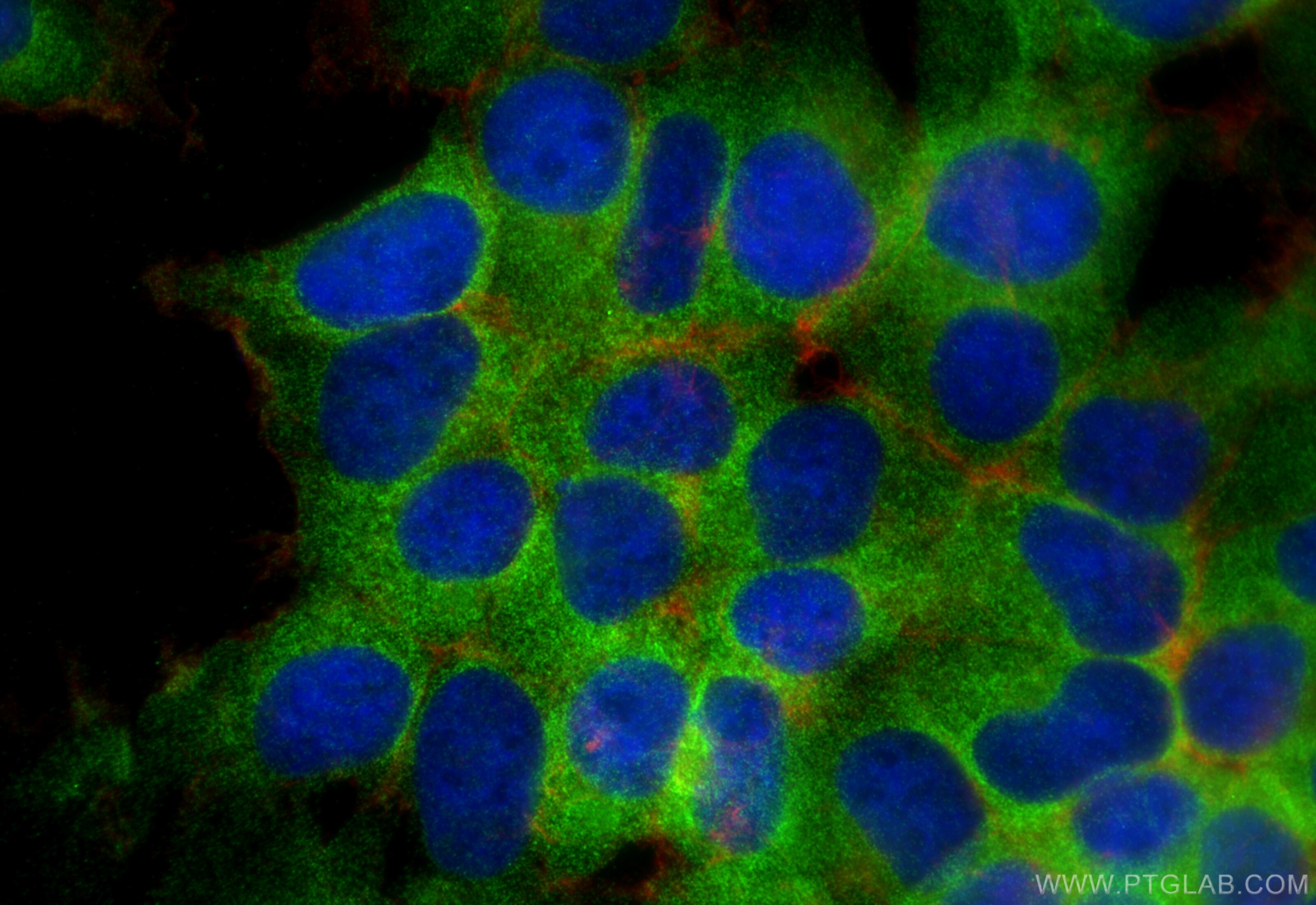Immunofluorescence (IF) / fluorescent staining of HEK-293 cells using UNK Polyclonal antibody (31574-1-AP)