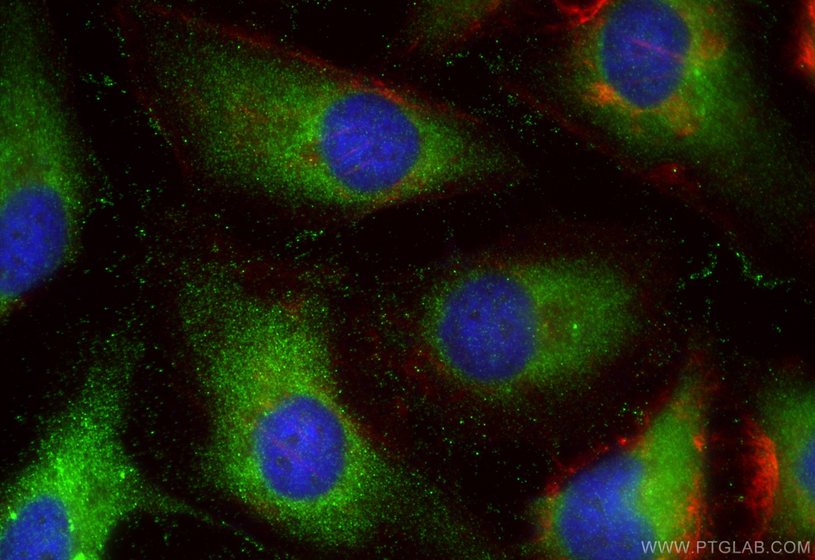 Immunofluorescence (IF) / fluorescent staining of HeLa cells using UNK Polyclonal antibody (31574-1-AP)