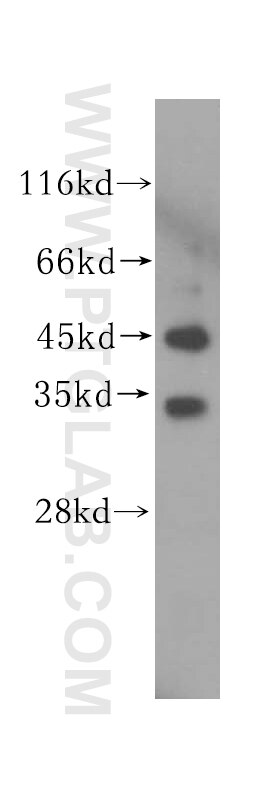 Western Blot (WB) analysis of HeLa cells using UNKL Polyclonal antibody (15000-1-AP)