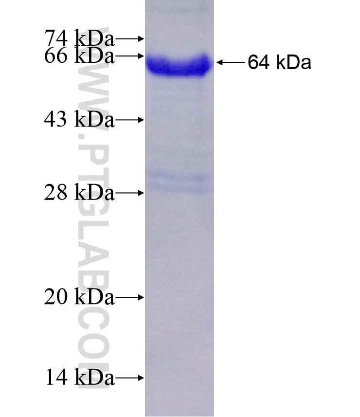 UNR; CSDE1 fusion protein Ag4173 SDS-PAGE