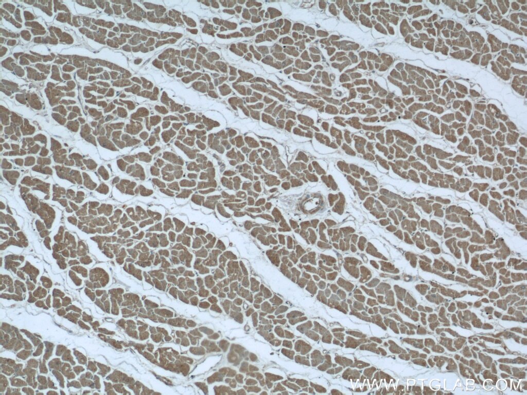 Immunohistochemistry (IHC) staining of human heart tissue using UPB1 Polyclonal antibody (24603-1-AP)