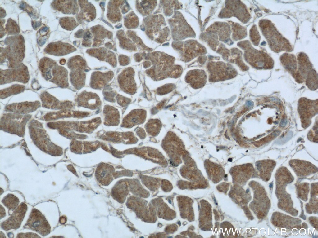 Immunohistochemistry (IHC) staining of human heart tissue using UPB1 Polyclonal antibody (24603-1-AP)