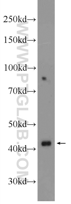 Western Blot (WB) analysis of mouse liver tissue using UPB1 Polyclonal antibody (24603-1-AP)