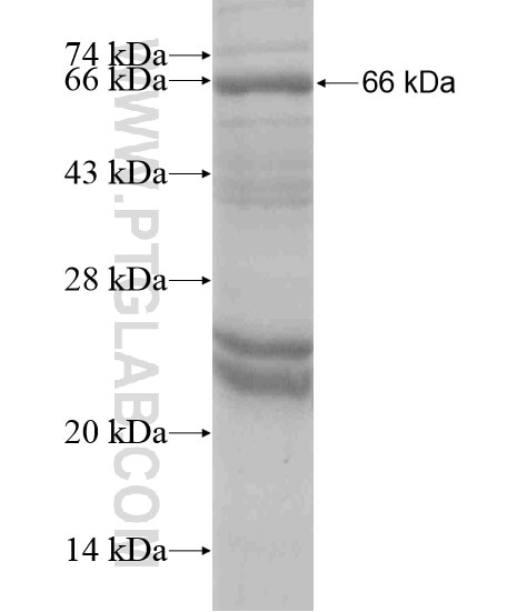 UPB1 fusion protein Ag18960 SDS-PAGE