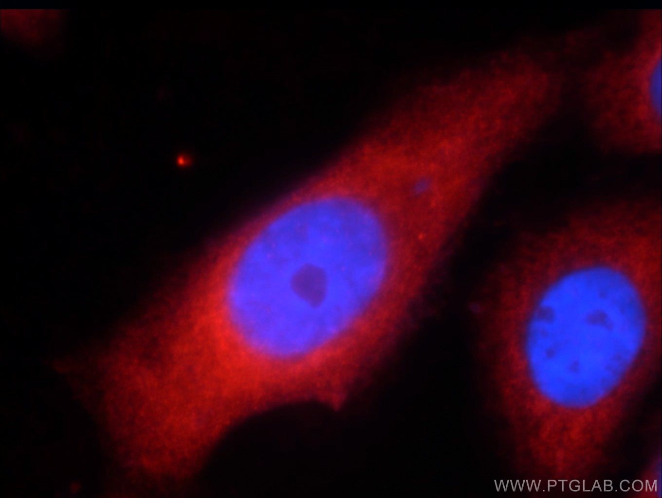 Immunofluorescence (IF) / fluorescent staining of HepG2 cells using UPF1 Polyclonal antibody (23379-1-AP)