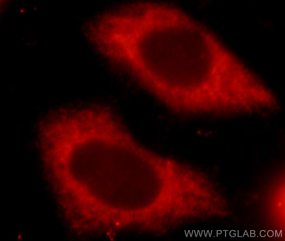 Immunofluorescence (IF) / fluorescent staining of MCF-7 cells using UPF1 Polyclonal antibody (23379-1-AP)