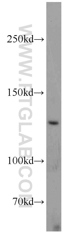 UPF1 Polyclonal antibody