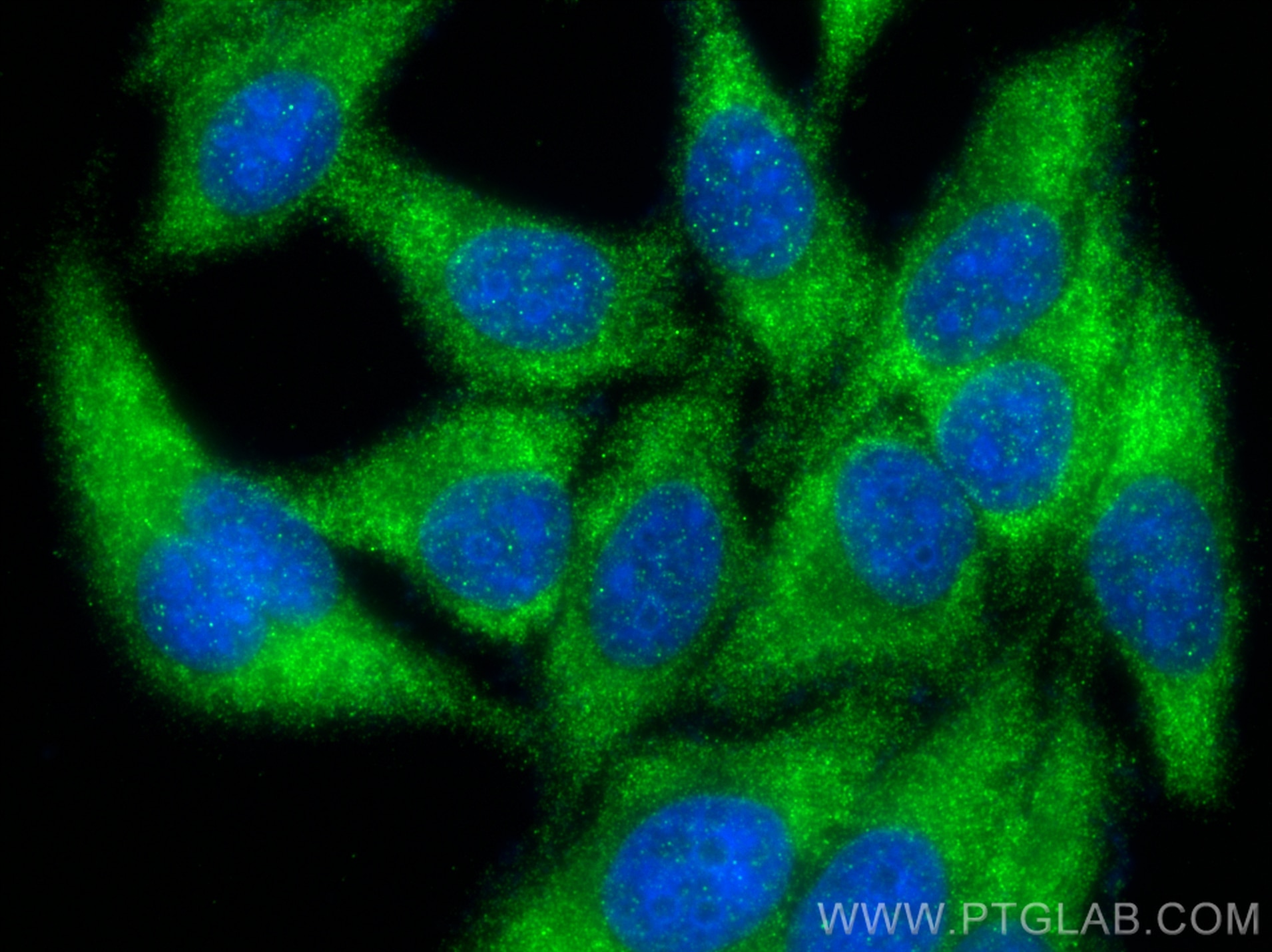 Immunofluorescence (IF) / fluorescent staining of HepG2 cells using UPF1 Polyclonal antibody (28384-1-AP)