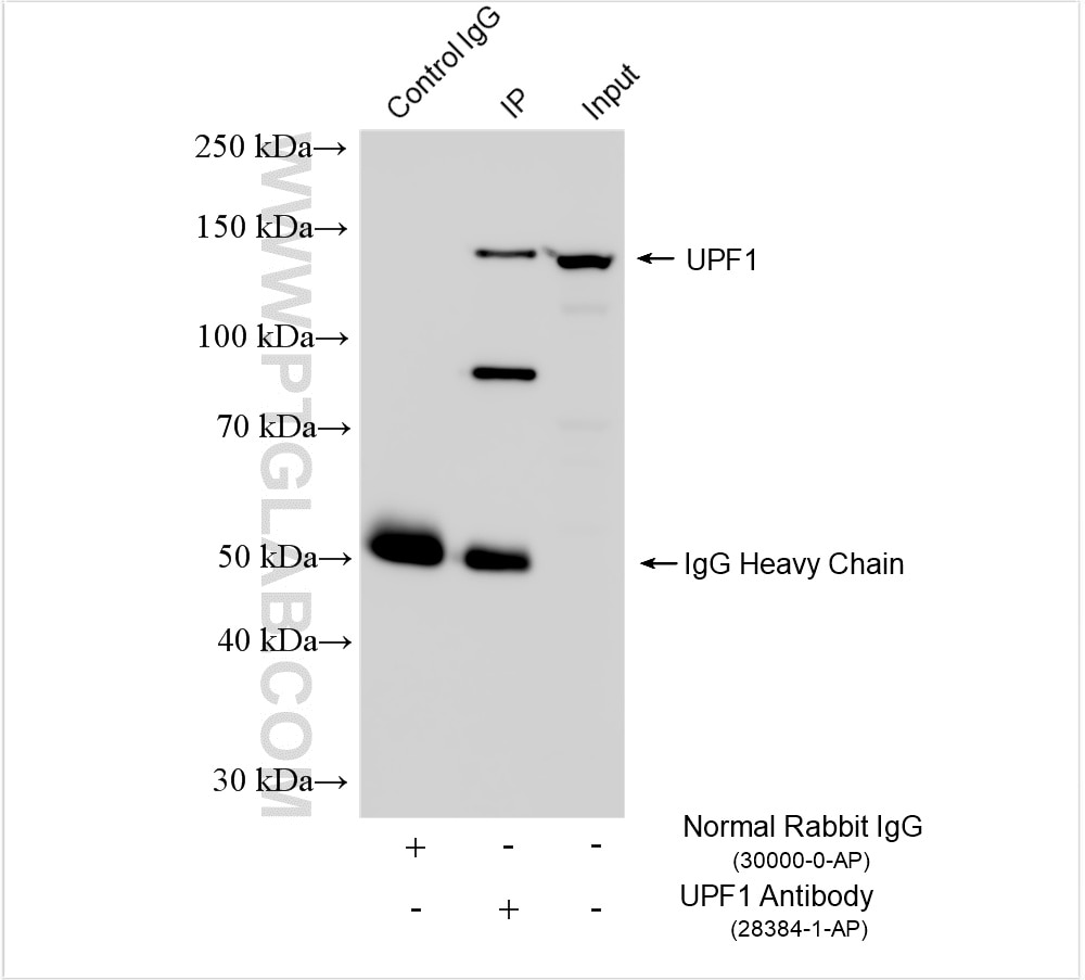 Immunoprecipitation (IP) experiment of HeLa cells using UPF1 Polyclonal antibody (28384-1-AP)