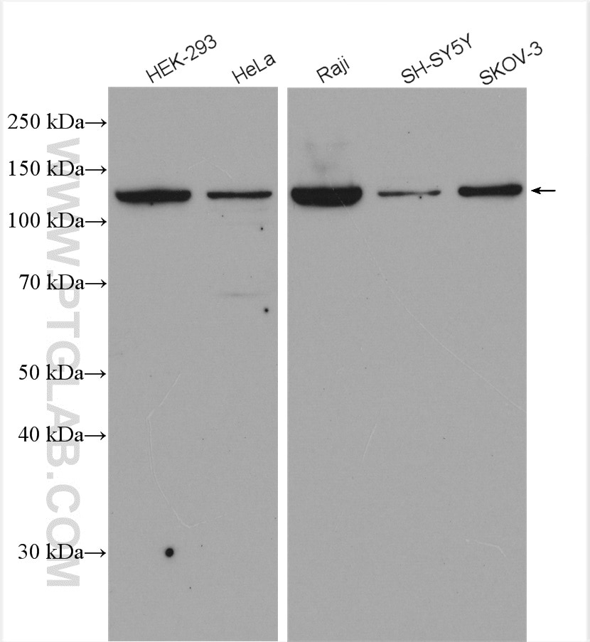 Western Blot (WB) analysis of various lysates using UPF1 Polyclonal antibody (28384-1-AP)