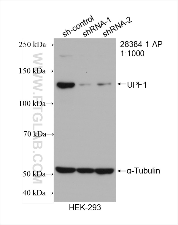 Western Blot (WB) analysis of HEK-293 cells using UPF1 Polyclonal antibody (28384-1-AP)