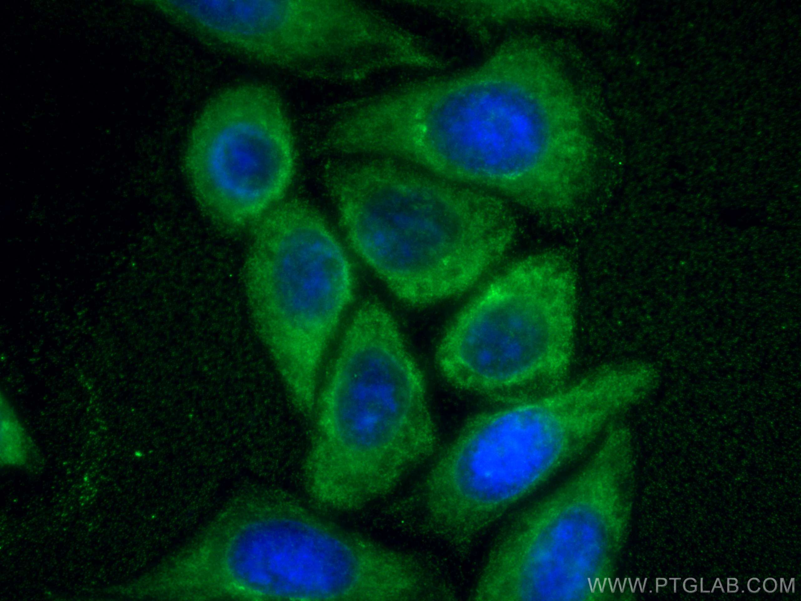 Immunofluorescence (IF) / fluorescent staining of HepG2 cells using UPF1 Monoclonal antibody (66898-1-Ig)