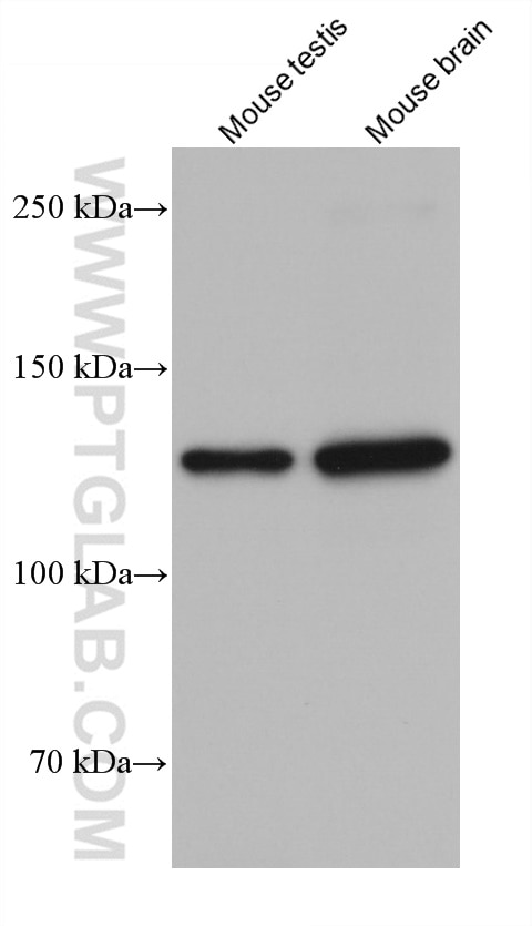 Western Blot (WB) analysis of various lysates using UPF1 Monoclonal antibody (66898-1-Ig)