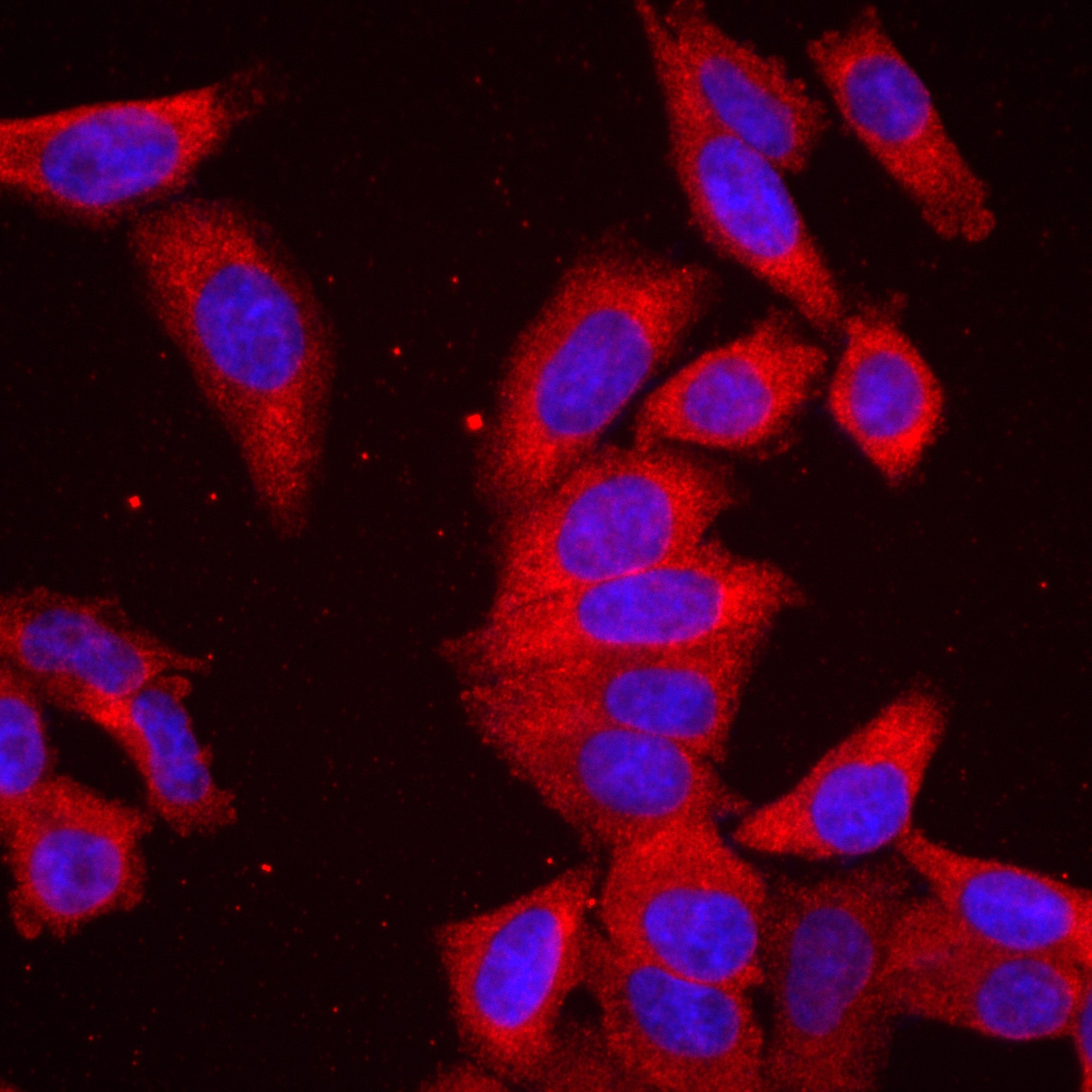 Immunofluorescence (IF) / fluorescent staining of HepG2 cells using UPF1 Recombinant antibody (82791-1-RR)