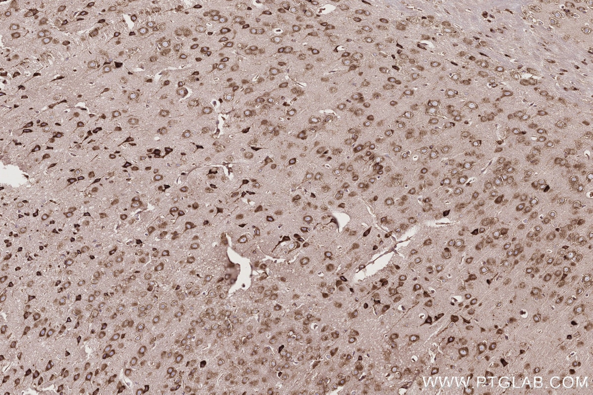 IHC staining of mouse brain using 82791-1-RR Immunohistochemistry (IHC) staining of mouse brain tissue using UPF1 Recombinant monoclonal antibody (82791-1-RR)