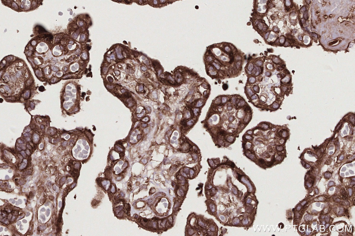 IHC staining of human placenta using 82791-1-RR Immunohistochemistry (IHC) staining of human placenta tissue using UPF1 Recombinant monoclonal antibody (82791-1-RR)