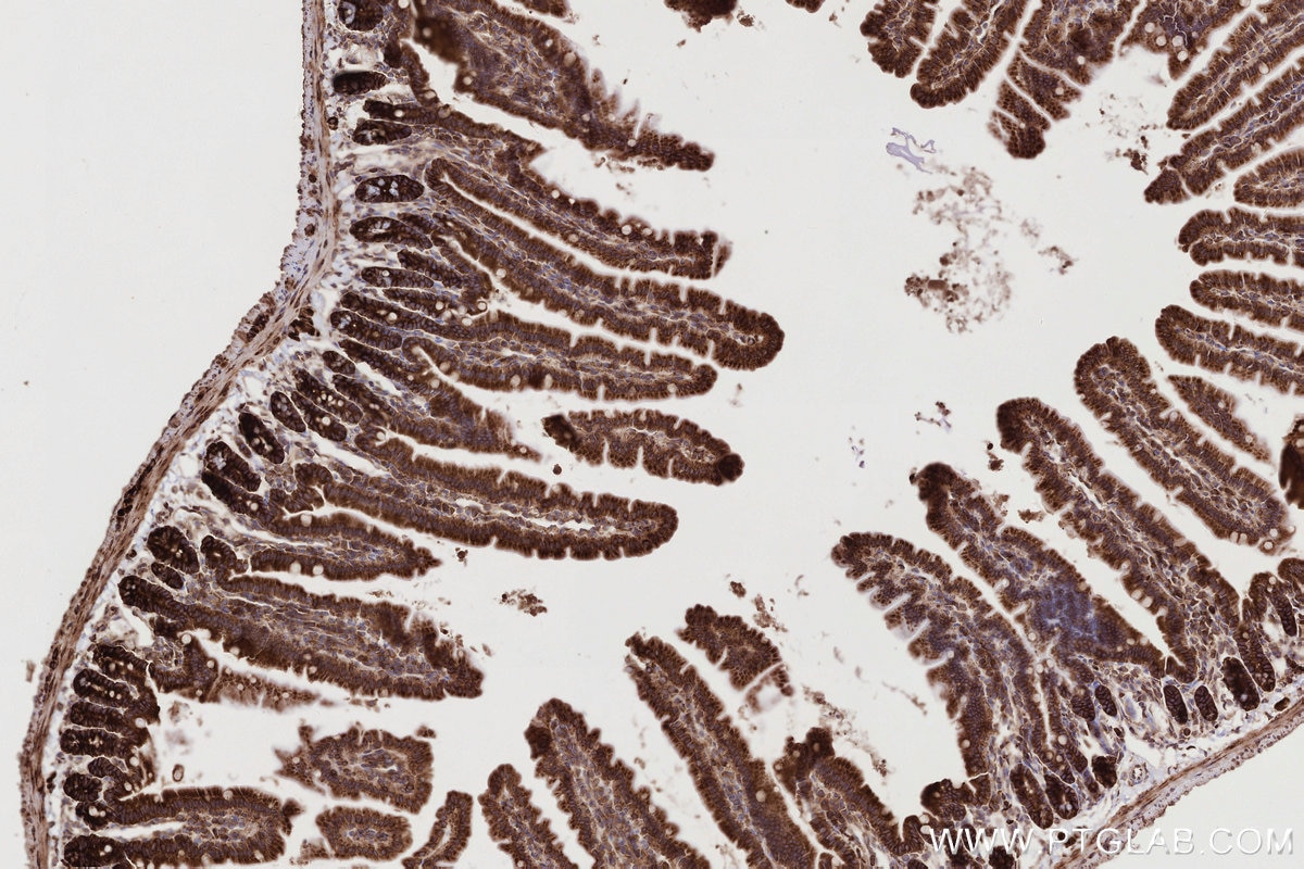 IHC staining of mouse small intestine using 82791-1-RR Immunohistochemistry (IHC) staining of mouse small intestine tissue using UPF1 Recombinant monoclonal antibody (82791-1-RR)