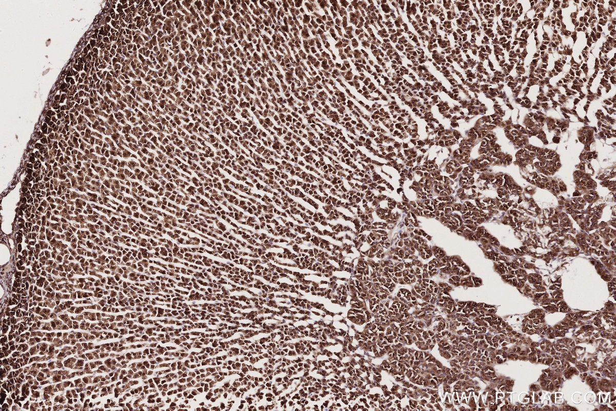 IHC staining of rat adrenal gland using 82791-1-RR Immunohistochemistry (IHC) staining of rat adrenal gland tissue using UPF1 Recombinant monoclonal antibody (82791-1-RR)