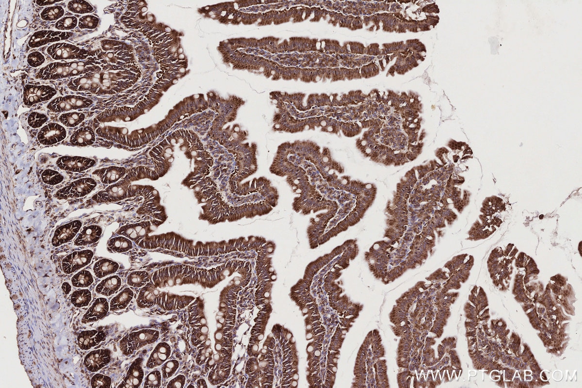 IHC staining of rat small intestine using 82791-1-RR Immunohistochemistry (IHC) staining of rat small intestine tissue using UPF1 Recombinant monoclonal antibody (82791-1-RR)